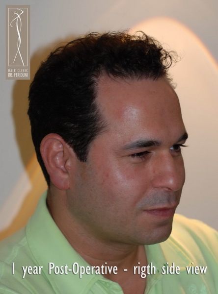 Image uploaded by: Dr Feriduni Hair Clinic