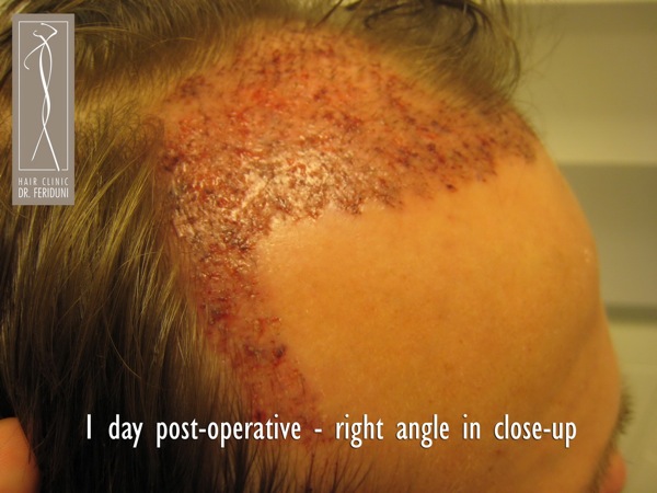Image uploaded by: Dr Feriduni Hair Clinic