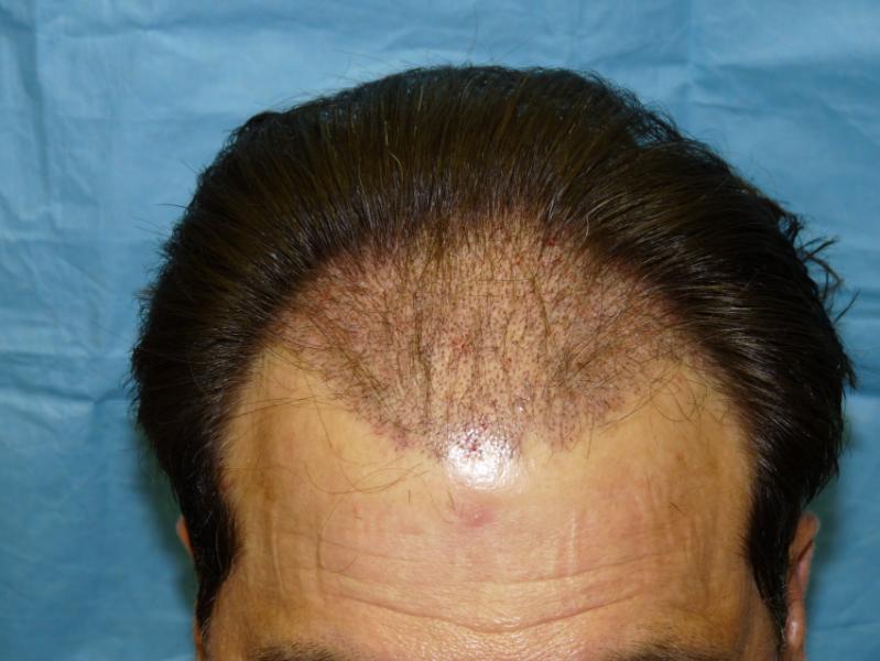 Image uploaded by: Vladimir Panine, MD