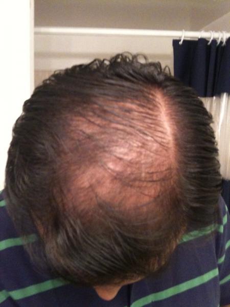 Image uploaded by: almostgoingbald