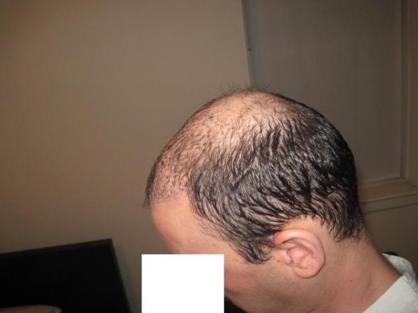Image uploaded by: mbd