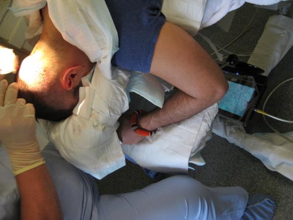 Day1 FUE Hair Transplant Dr Woods - Being able to see the donor hair being removed on the monitor - Called MODE