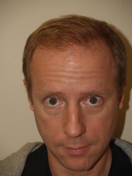 Image uploaded by: Jeffrey Epstein, MD