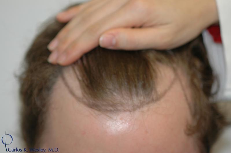 Image uploaded by: Carlos Wesley, MD