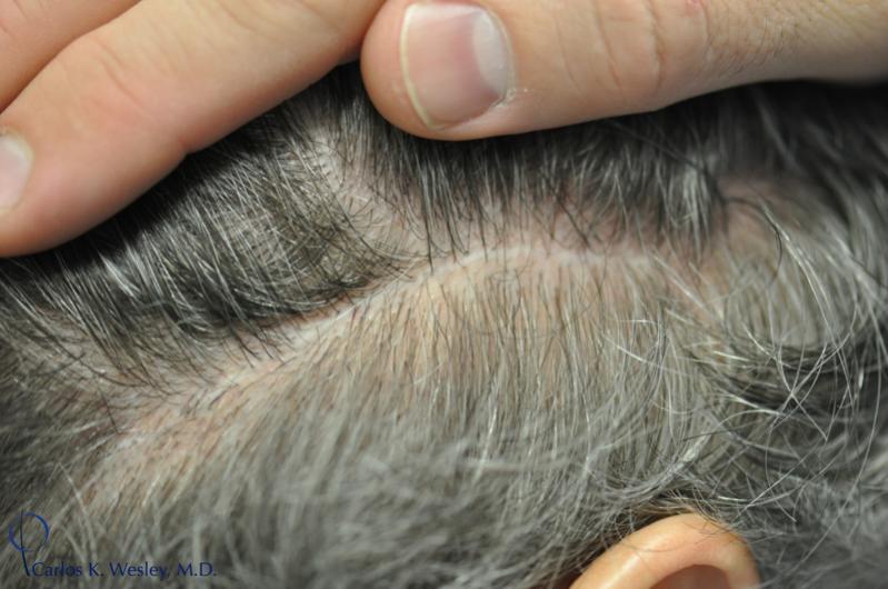 Image uploaded by: Carlos Wesley, MD