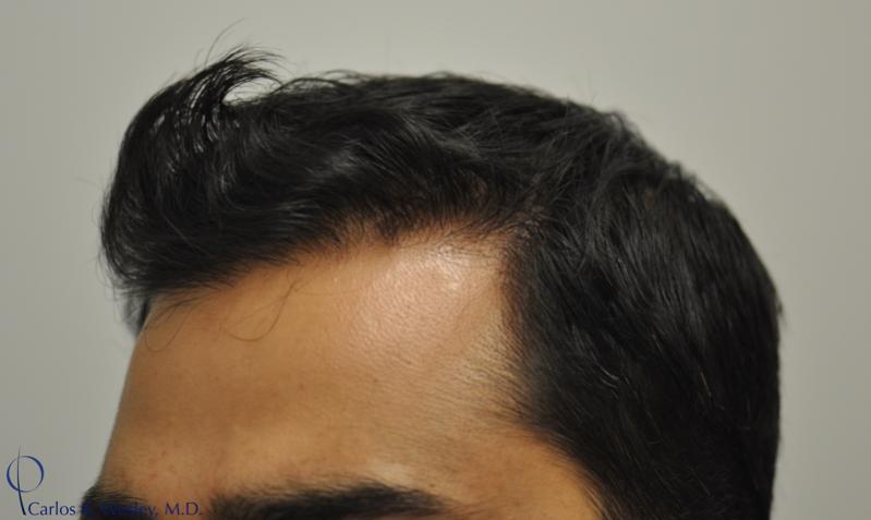Image uploaded by: Carlos Wesley, MD
