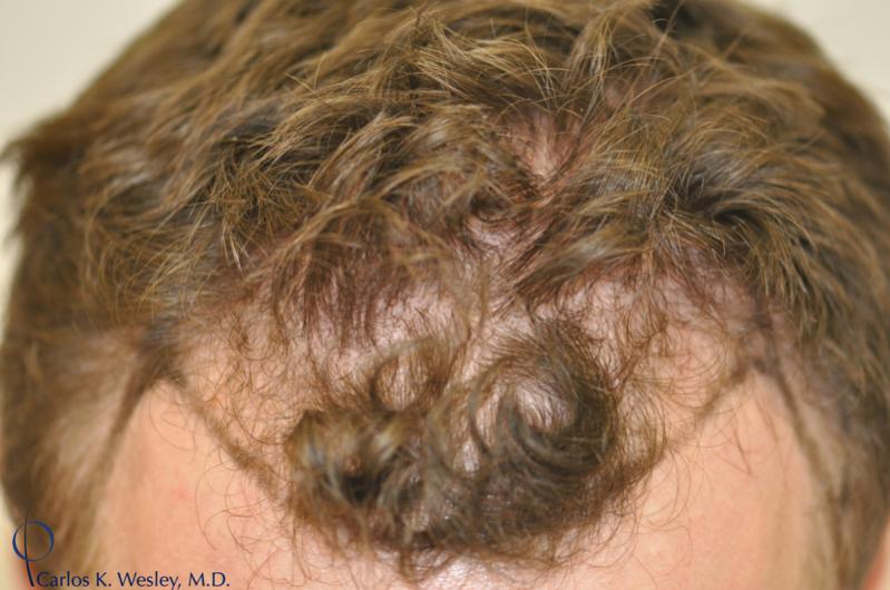 Image uploaded by: Carlos Wesley, MD