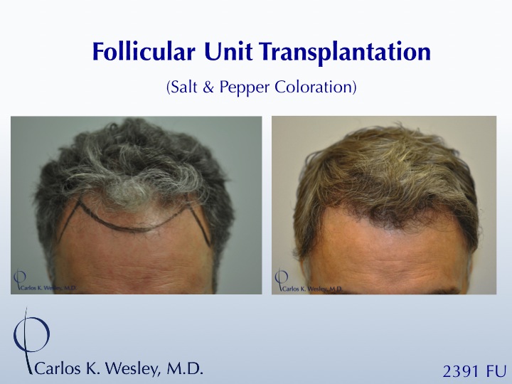 Image uploaded by: Carlos Wesley, MD