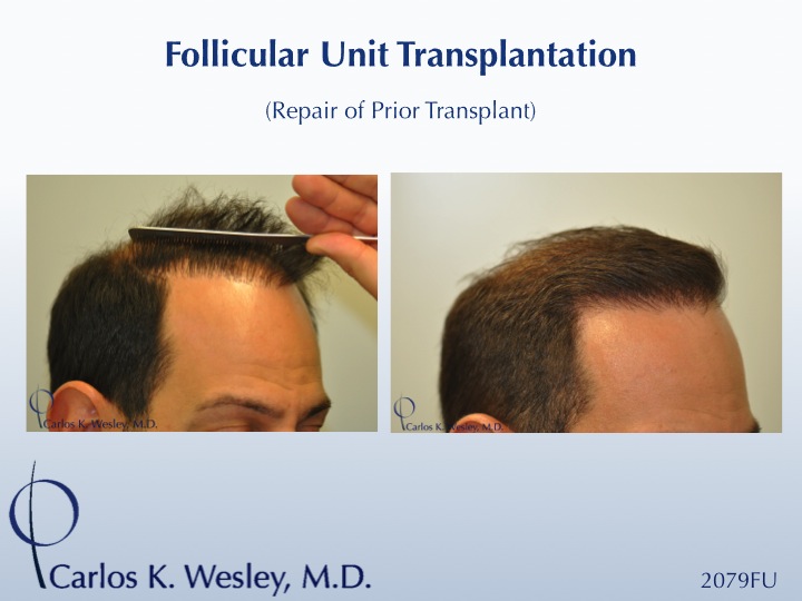 Image uploaded by: Carlos Wesley, MD