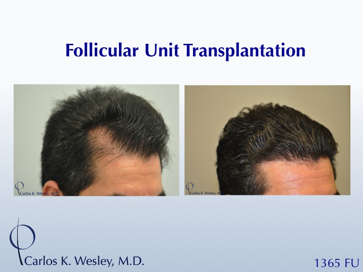 Image uploaded by: Carlos Wesley, MD