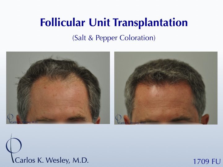 A video montage of this patient's transformation may be viewed here:

https://vimeo.com/67214017