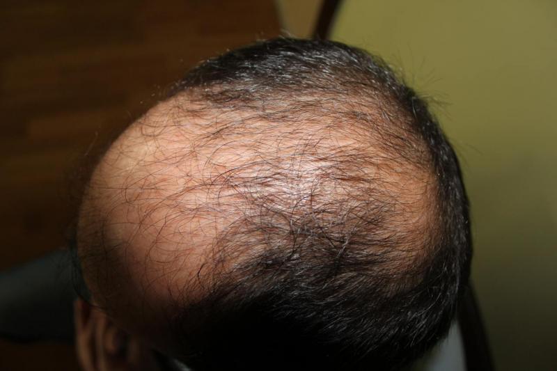 Image uploaded by: Hakan Doganay, MD