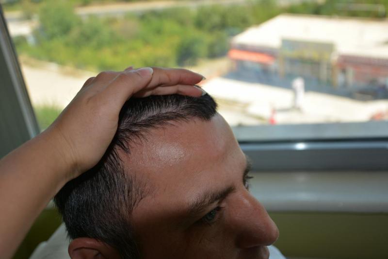 Image uploaded by: Hakan Doganay, MD