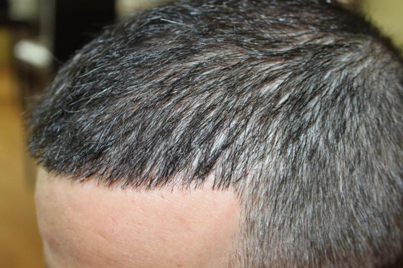 Image uploaded by: Hakan Doganay, MD