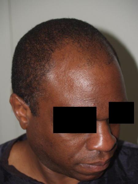 Image uploaded by: Jeffrey Epstein, MD
