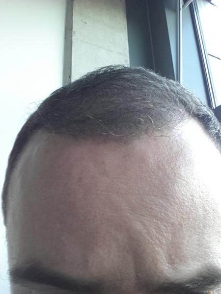 Image uploaded by: londonhair