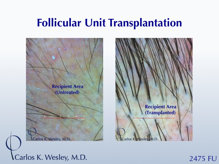 Image uploaded by: Carlos Wesley, MD