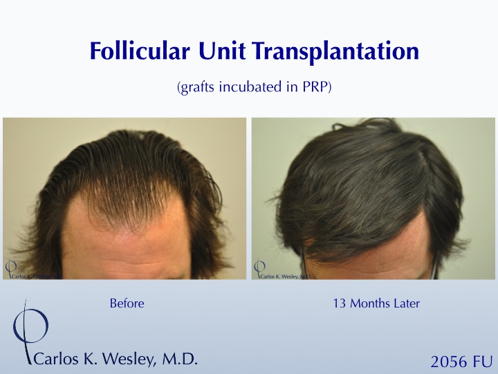 Image uploaded by: Carlos Wesley, MD