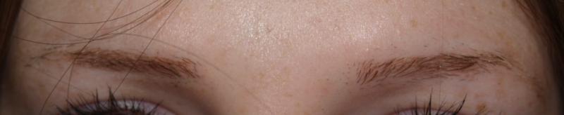 Image uploaded by: Jeffrey Epstein, MD
