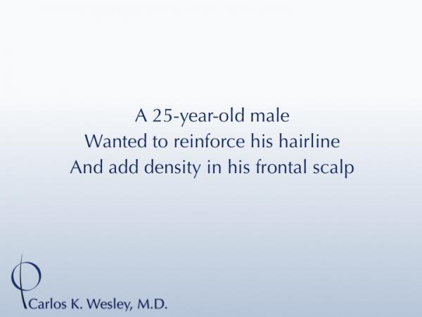 25-year-old male with 2034 FU session with Dr. Carlos K. Wesley for hairline fullness.