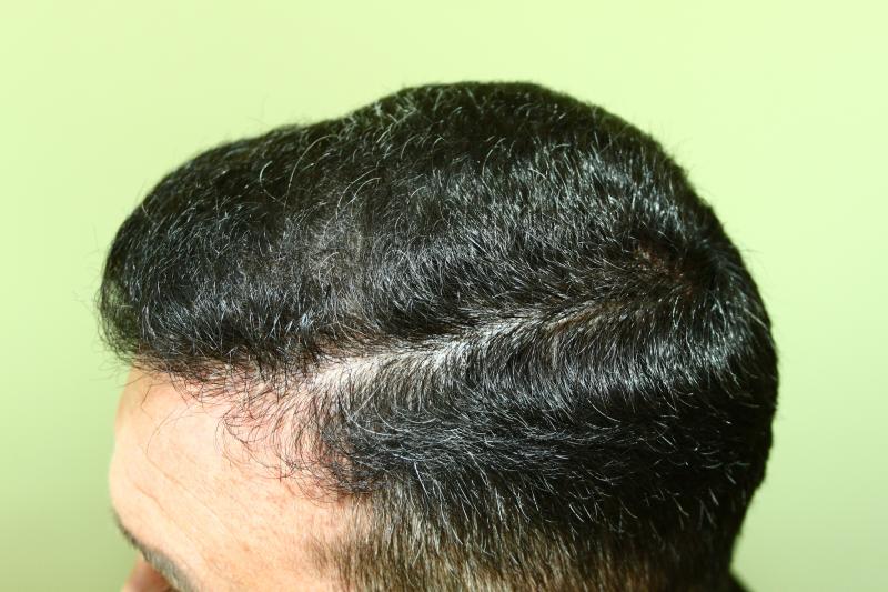 Image uploaded by: Hakan Doganay, MD