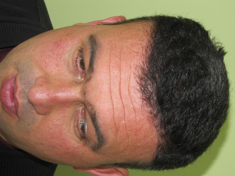 Image uploaded by: Hakan Doganay, MD