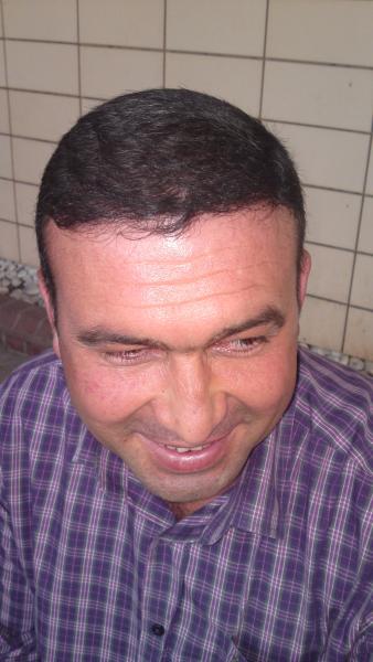 Image uploaded by: Hakan Doganay, MD
