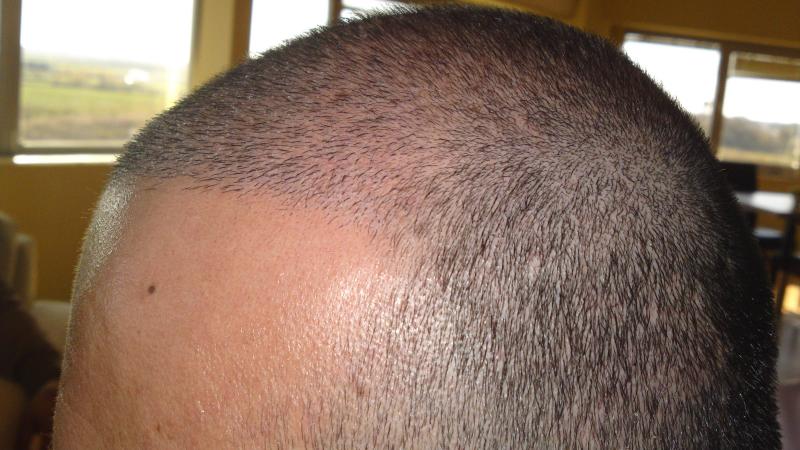 Image uploaded by: Hakan Doganay, MD