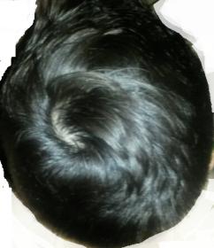 Another Balding Or Thinning Crown Opinions Please Baldtruthtalk Com