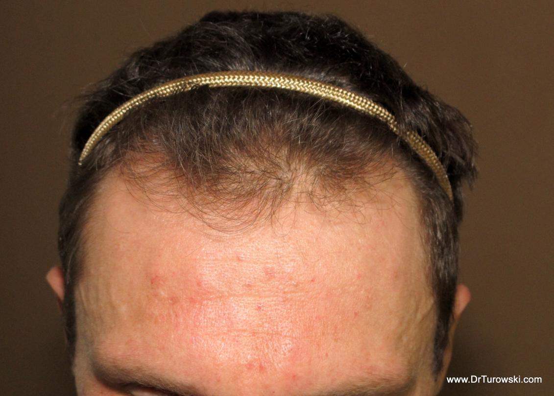 Image uploaded by: Gregory Turowski, MD