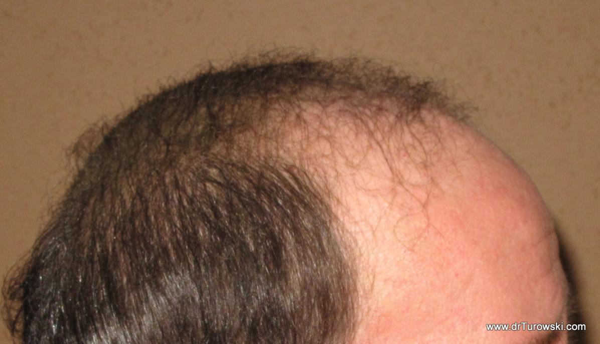 Image uploaded by: Gregory Turowski, MD