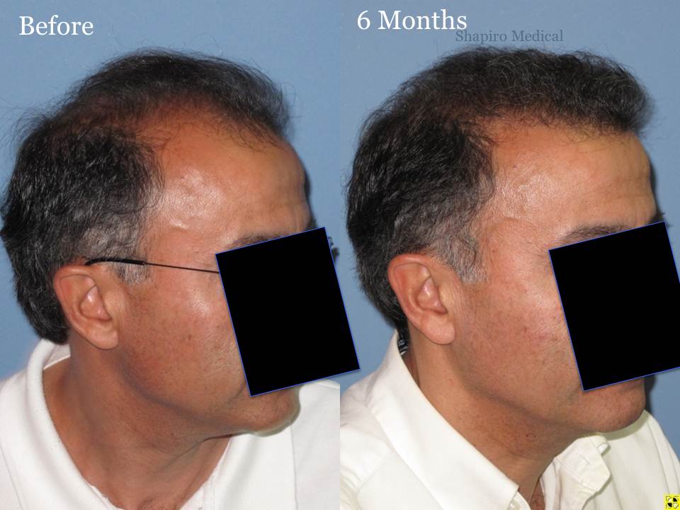 Image uploaded by: Paul Shapiro, MD