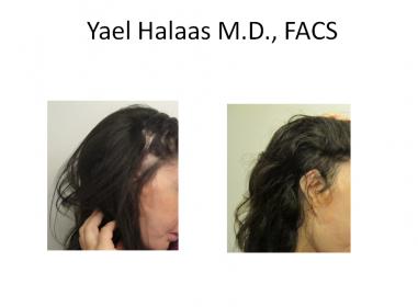 Image uploaded by: Yael Halaas, MD