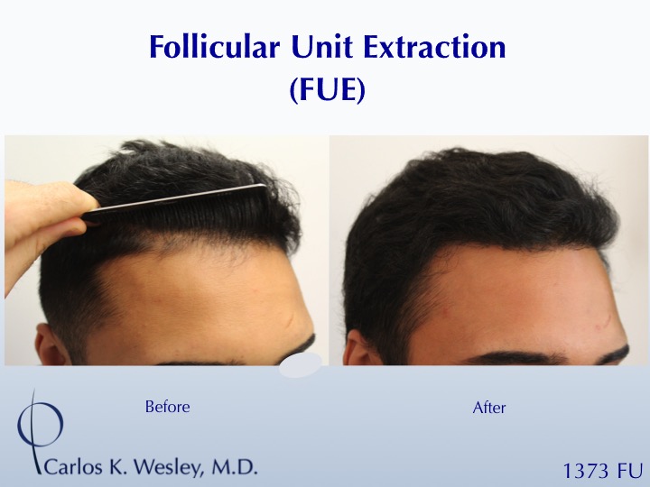 Image uploaded by: Carlos Wesley, MD