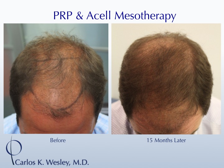 Image uploaded by: Carlos Wesley, MD