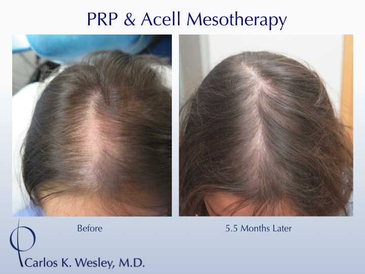 Image uploaded by: Carlos Wesley, MD