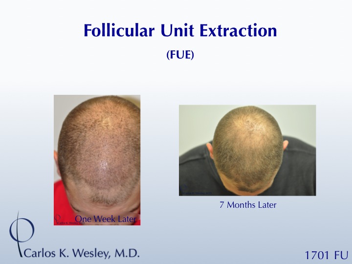 Image uploaded by: Carlos Wesley, MD