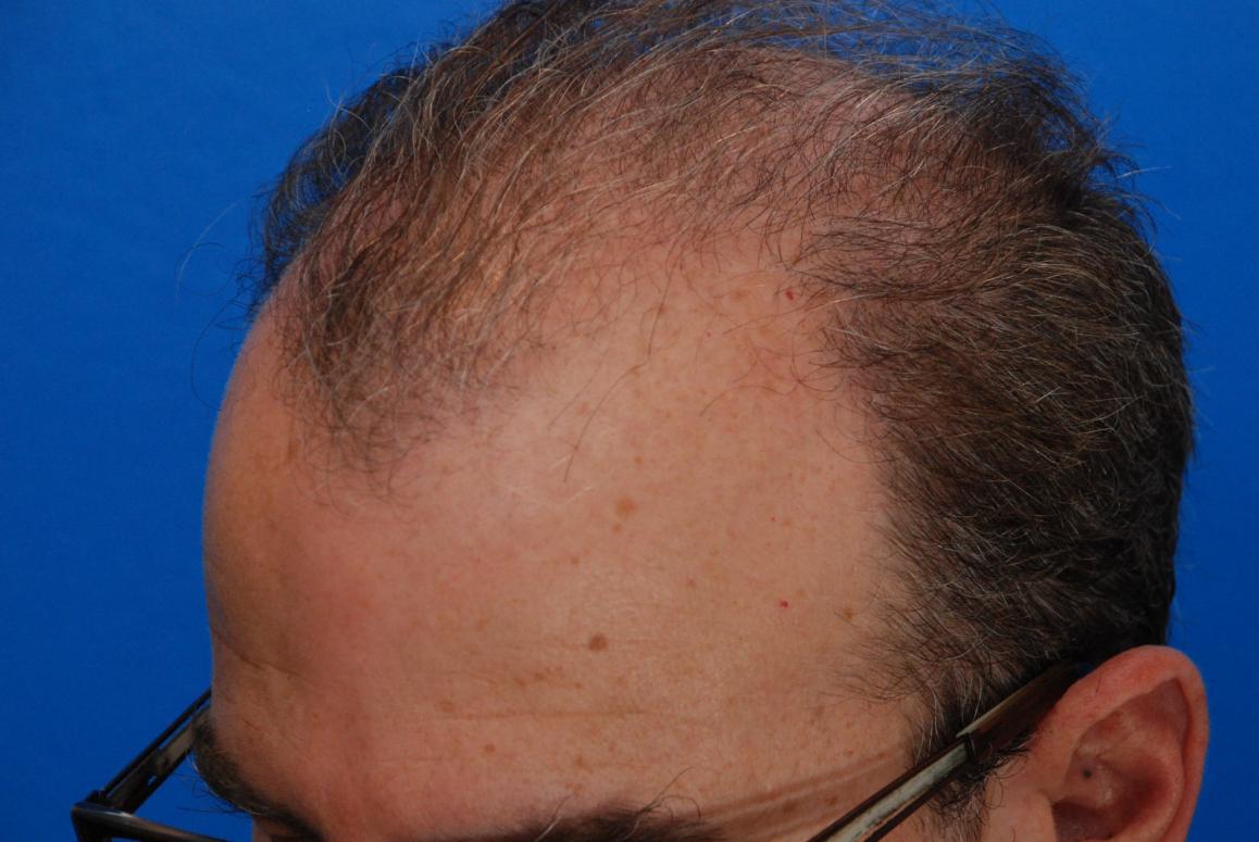 Image uploaded by: Scott Boden, MD