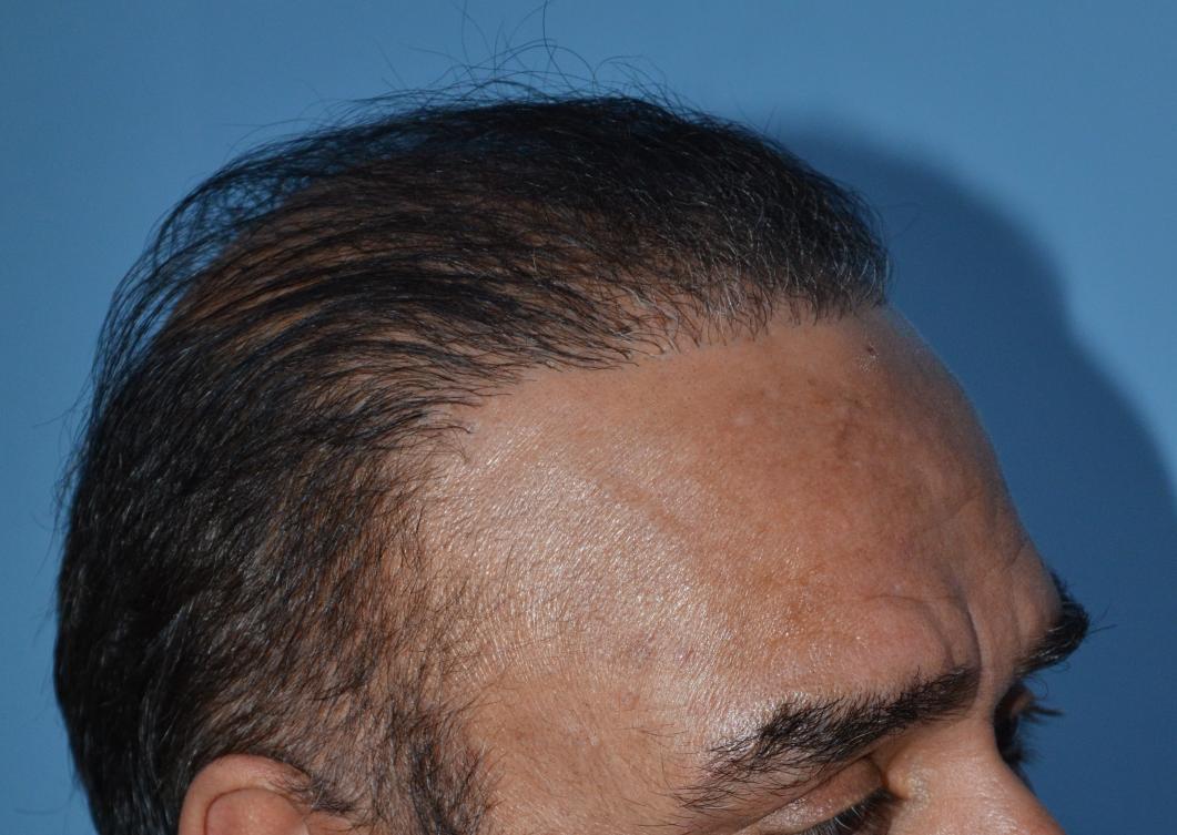 Click image for larger version

Name:	Darling Buds Hair transplant clinic India (5).jpg

Size:	95.9 KB
ID:	50291