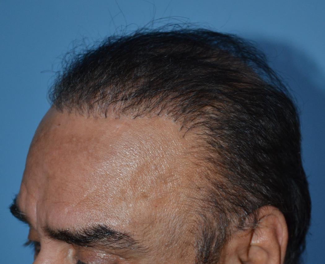 Click image for larger version

Name:	Darling Buds Hair transplant clinic India (4).jpg

Size:	90.9 KB
ID:	50292