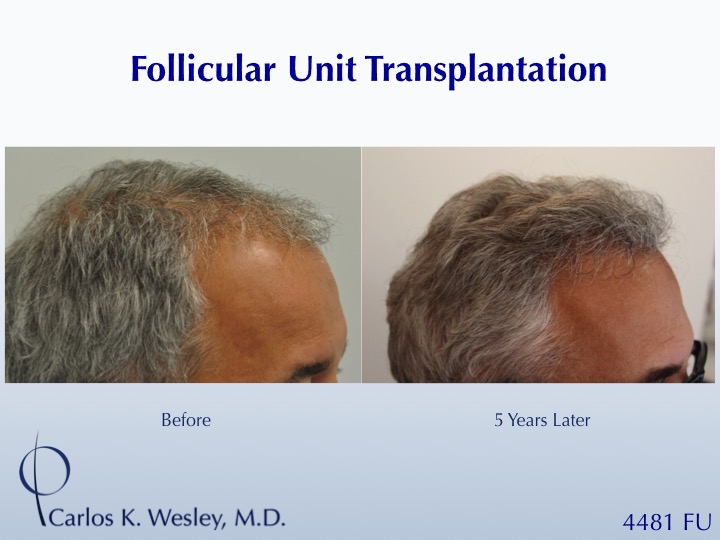 CARLOS K. WESLEY, MD (NYC) - LB