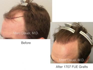 Image uploaded by: Marc Dauer, MD