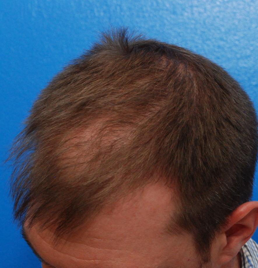 Image uploaded by: Scott Boden, MD