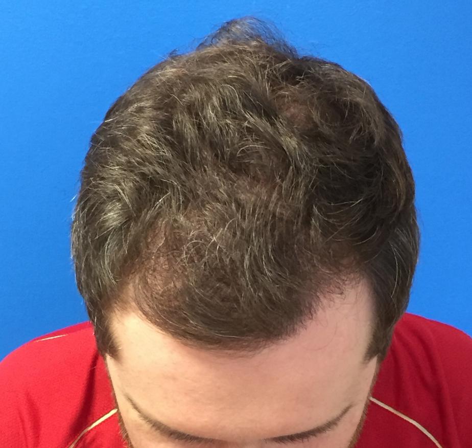 Image uploaded by: Scott Boden, MD