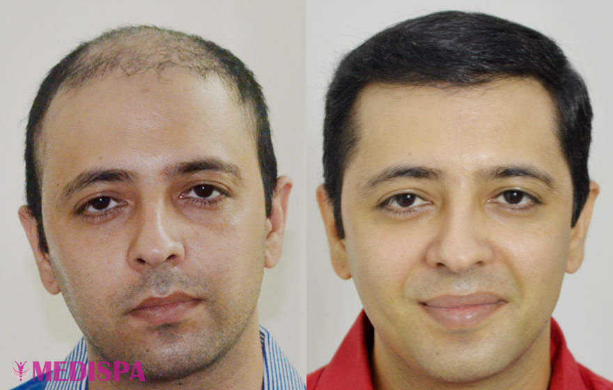 Image uploaded by: Dr. Suneet Soni Clinic