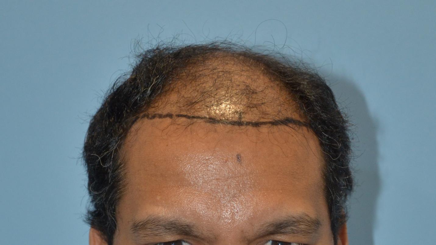 Click image for larger version

Name:	Darling Buds Hair Transplant Clinic (1).jpg

Size:	93.8 KB
ID:	57481