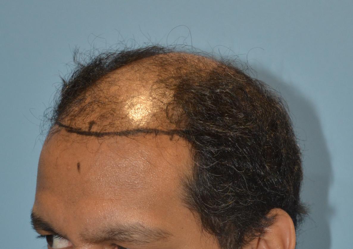 Click image for larger version

Name:	Darling Buds Hair Transplant Clinic (2).jpg

Size:	93.1 KB
ID:	57482
