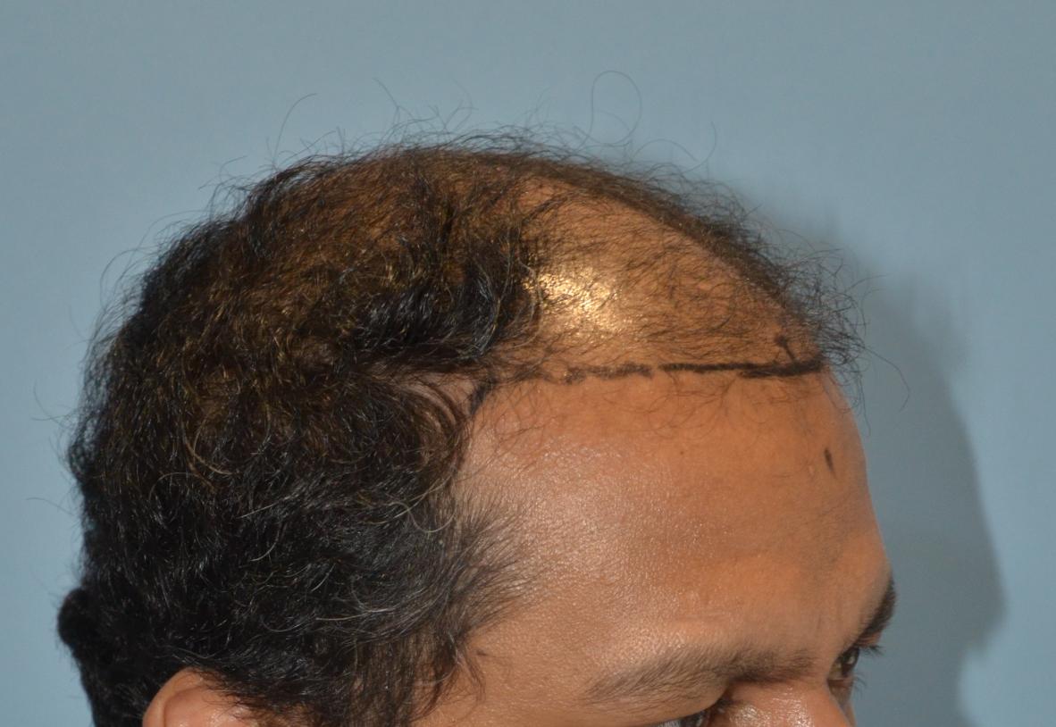 Click image for larger version

Name:	Darling Buds Hair Transplant Clinic (3).jpg

Size:	93.0 KB
ID:	57483