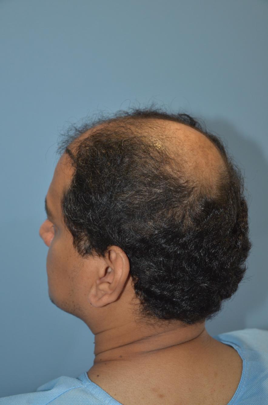 Click image for larger version

Name:	Darling Buds Hair Transplant Clinic (7).jpg

Size:	92.7 KB
ID:	57485