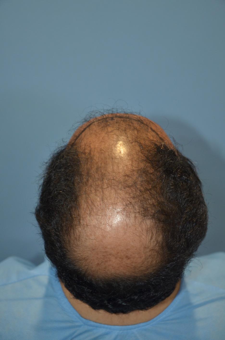 Click image for larger version

Name:	Darling Buds Hair Transplant Clinic (8).jpg

Size:	92.1 KB
ID:	57486